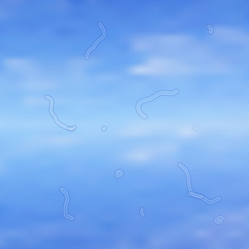 Flashes and floaters
