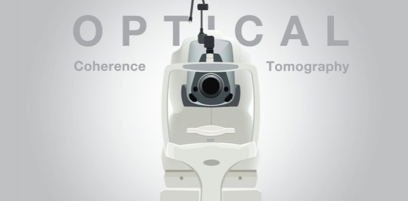 OCT eye scan: A non-invasive imaging technique using light to create a 3D image of the body's interior.