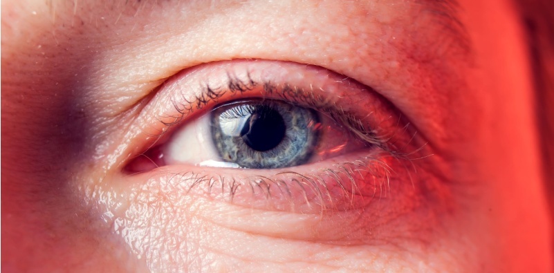 Zoomed image of teary eyes